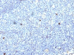Mouse anti-HLA A, Clone: SPM418, Novus Biologicals 0.2mg; Unlabeled:Antibodies,